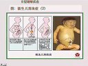 免疫学课程教学-超敏反应