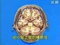 头颅横断层解剖教学视频-医学院专用