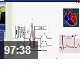 备战执考----2011年执业医师考试辅导第一讲