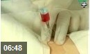 2011年临床执业（助理）医师资格考试实践技能应考辅导基本操作部分（二）