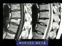 骨关节磁共振读片指导 人卫出版社教学课程