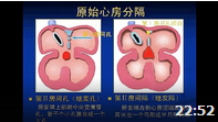 正常胎儿心脏胚胎发育的过程 超声医学