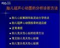 胎儿超声心动图的分析方法 北京安贞医院