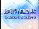 超声引导肝脏穿刺技术的临床操作