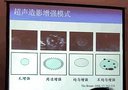 乳腺疾病的超声诊断方法讲座