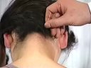 实用电针疗法腰扭伤和劳损