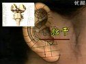 中医针炙之耳针疗法