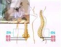 中医常见腰腿痛的推拿治疗