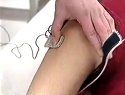 胆石症的中医治疗方法