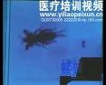 虫类药治疗疑难杂症的经验体会_朱良春