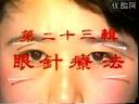 眼针疗法的临床操作和应用