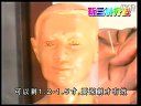 中医传统经典疗法-靳三针疗法眼三针