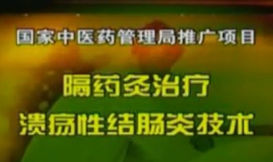 中医药推广项目-溃疡性结肠炎的隔药灸治疗