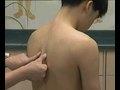 天灸治疗支气管哮喘技术 中医临床实用技术