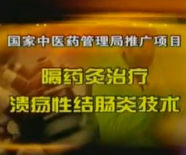 慢性溃疡性结肠炎的中医艾灸治疗