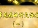 常见病针灸治疗和常用穴位介绍