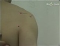 针灸取穴纲要教学片