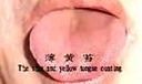 中医舌诊教学片 天津中医学院