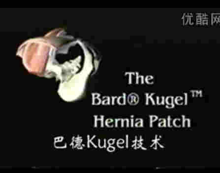 kugd疝修补术