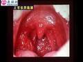 上海交大口腔医学院教学视频---口腔粘膜病学概论