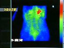 泌尿生殖系统放射性核素检查