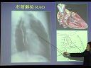 心脏与大血管疾病的医学影像学检查方法