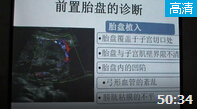 胎儿畸形的超声诊断方法