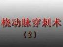 桡动脉穿刺技术的操作演示