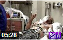 Cardioversion心脏电复律