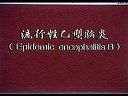乙脑的诊断和预防方法培训课程
