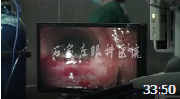 青光眼显微镜手术的操作过程