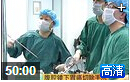 腹腔镜下胃癌切除手术全过程