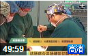 结肠癌合并肠梗阻切除手术