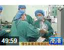 慢性鼻窦炎微创手术治疗