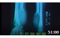 骨关节疾病的X线表现讲解