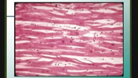 基础医学《形态病理学》USMLE（Morphological Pathology）
