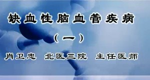 缺血性脑血管疾病视频教程 肖卫忠 4讲 北京大学