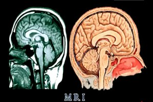人体解剖学视频教程 张书永 15讲 北京大学