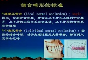 口腔正畸学视频教程 冯翠娟 15讲 中国医科大学