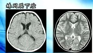 医学影像学视频教程 孙灿辉 10讲 中山大学