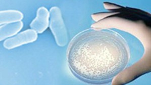 医学微生物学视频教程 庄辉,彭宜红 84讲 北京大学
