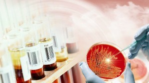 临床血液学检验视频教程 胡翊群 42讲 上海交通大学继续教育学院