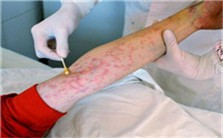流动人口是感染艾滋病的重点高危人群视频教程 林丹华 1讲 北京师范大学