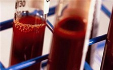 吃出来的疾病视频教程 王莲芸 4讲 上海交通大学