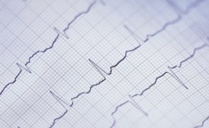 心电图视频教程 杨虎 4讲 北京大学