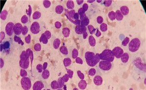 病理生理学视频教程 吴立玲 20讲 北京大学